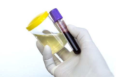 Urine and Blood Samples